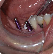 Impressions #30 and 31