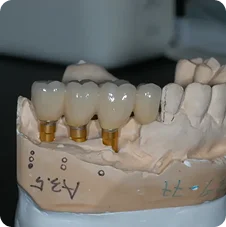 Crowns before placement